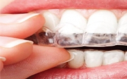 Alleanza Odontologia Integrada